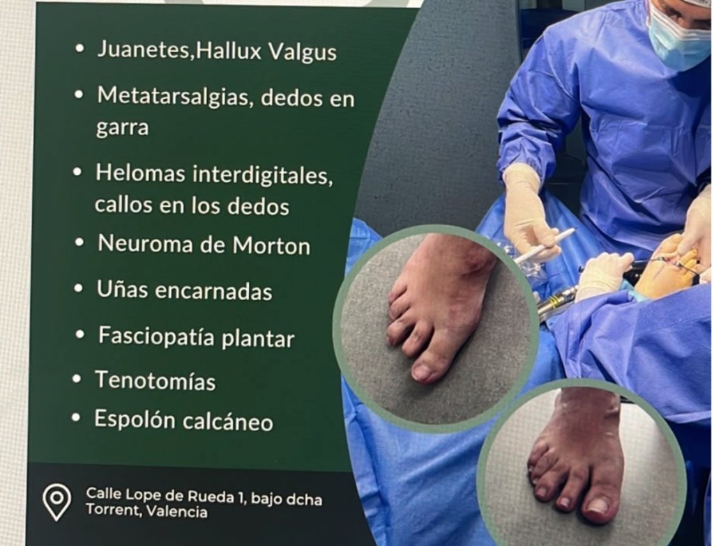 Cartel oficial de cirugías del pie en Torrent por Clínica Savan